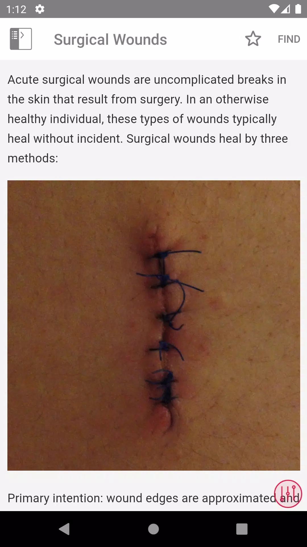 Wound Care MI Visual应用截图第4张