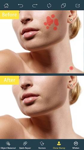 Photo Retouch-Object Removal Скриншот 2