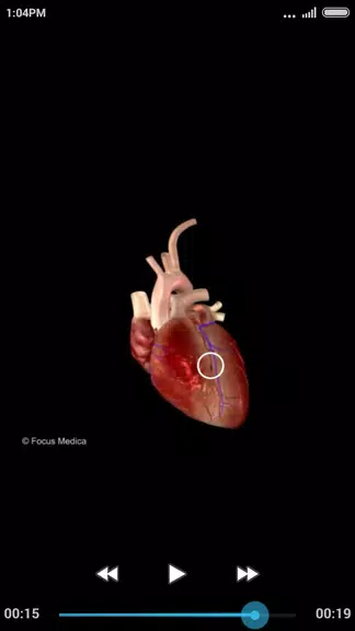 Cardiology-Animated Dictionary স্ক্রিনশট 3