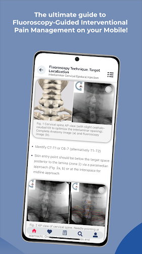 Interventional Pain App स्क्रीनशॉट 4