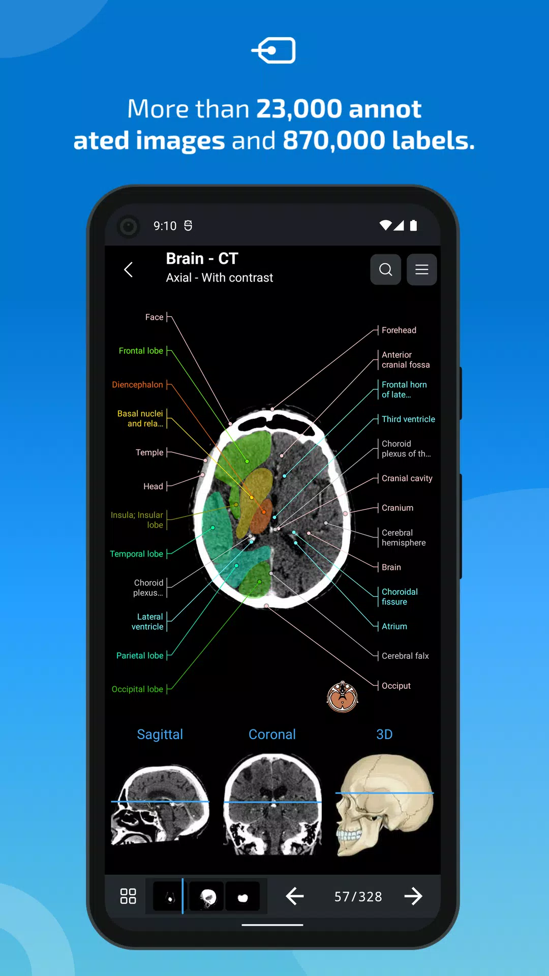 e-Anatomy Ảnh chụp màn hình 2