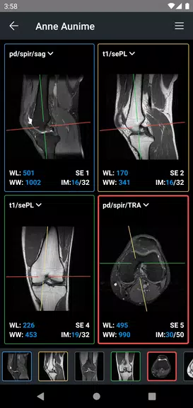 Schermata IDV - IMAIOS DICOM Viewer 3