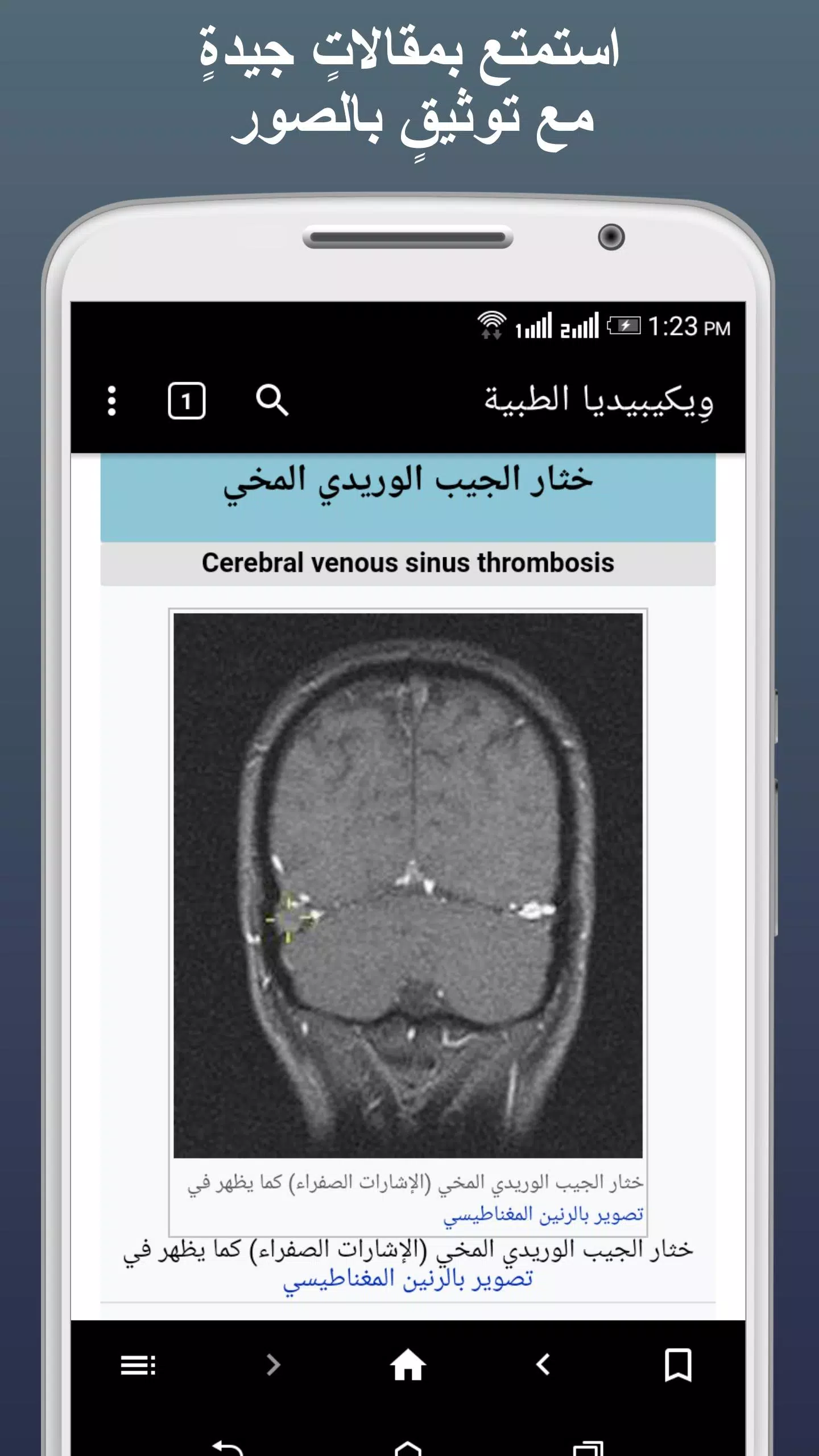 ويكيبيديا الطبية应用截图第3张