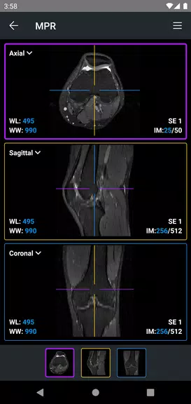 Schermata IDV - IMAIOS DICOM Viewer 4