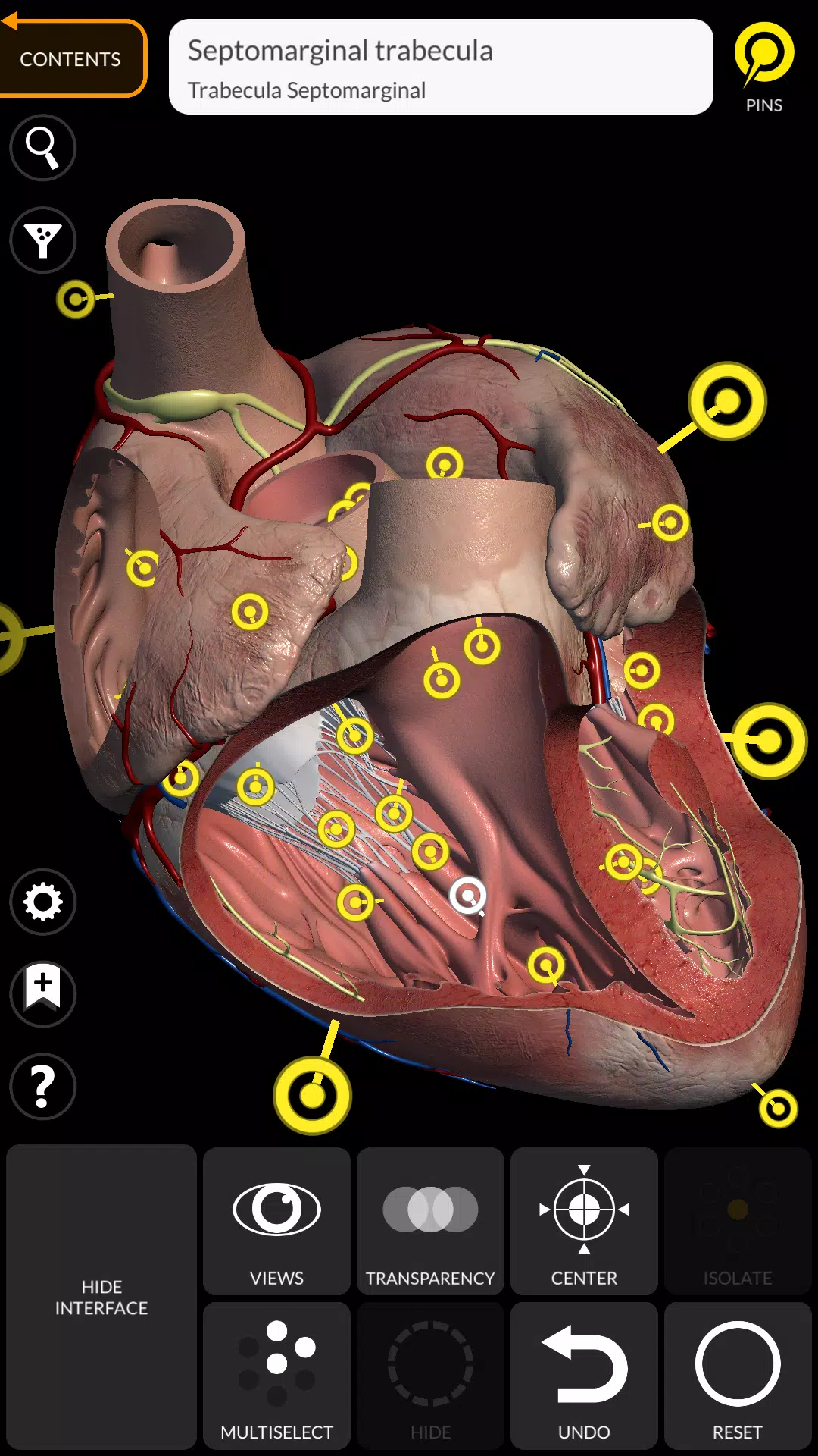 Schermata Anatomy 3D Atlas 3