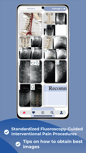 Interventional Pain App स्क्रीनशॉट 3